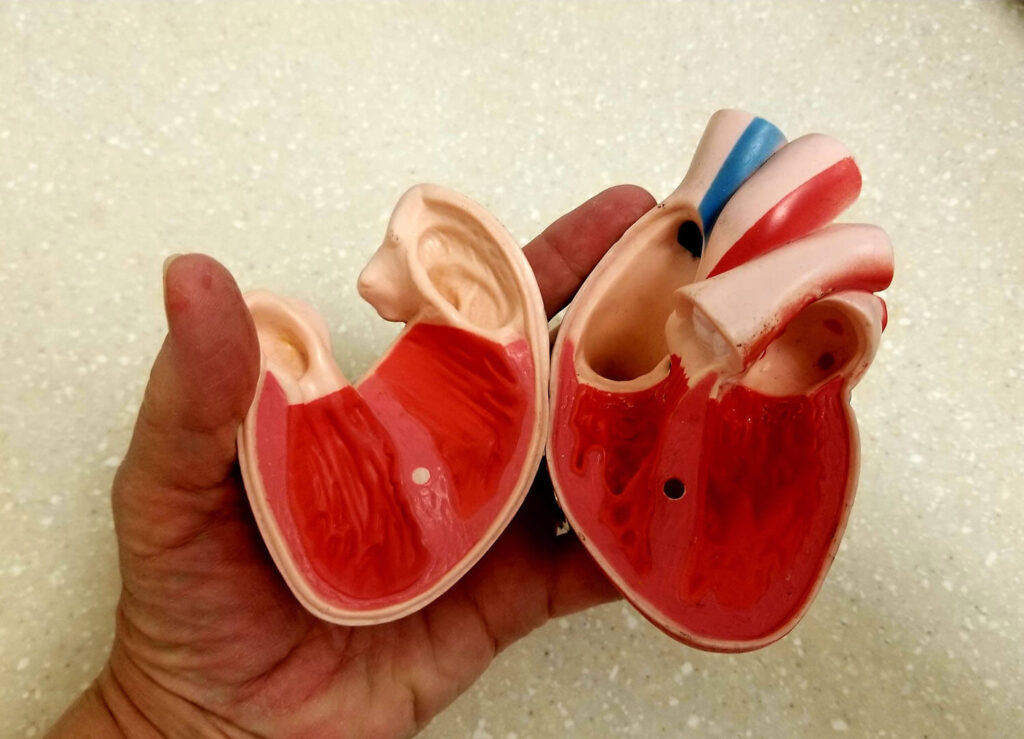 Budowa mięśnia sercowego - wyjaśnia specjalista